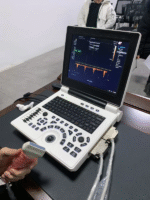 Ultrasound Machine – Laptop Ultrasonic Diagnostic System (Portable) - Image 4