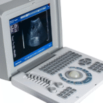 Digital Portable Full Ultrasound Machine – Oriel Plus - Image 2
