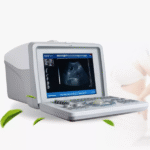 Digital Portable Full Ultrasound Machine – Oriel Plus - Image 3