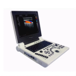 Ultrasound Machine – Laptop Ultrasonic Diagnostic System (Portable)