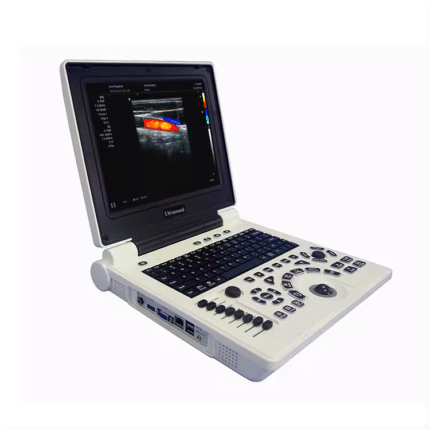 Ultrasound Machine – Laptop Ultrasonic Diagnostic System (Portable)